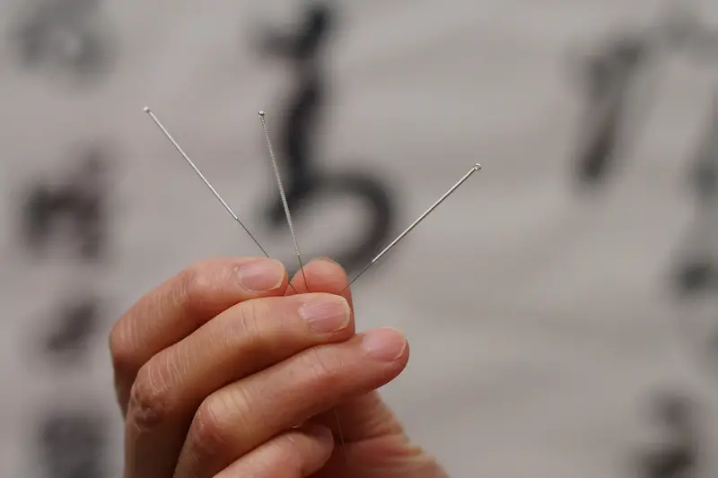 Acupuncture needles - precision instruments of Traditional Chinese Medicine